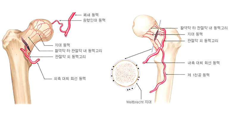 원인